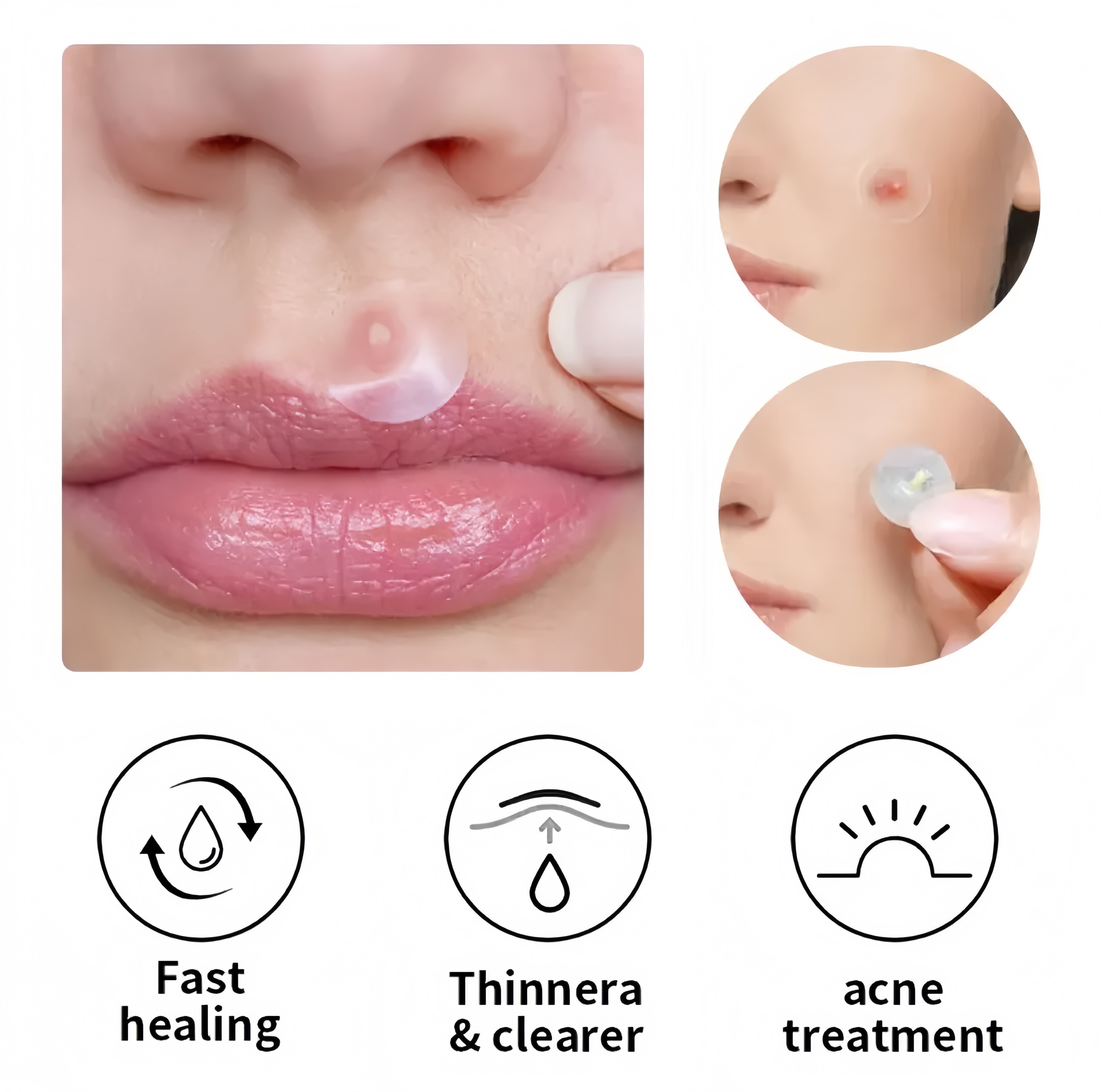 RapidClea Hydrocolloid Pimple Patches